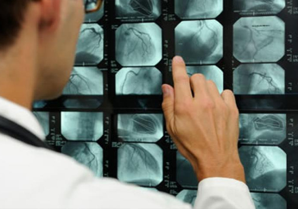 Angiography Cost in India