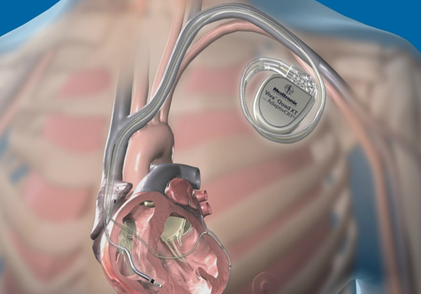 Best Cardiologist in India